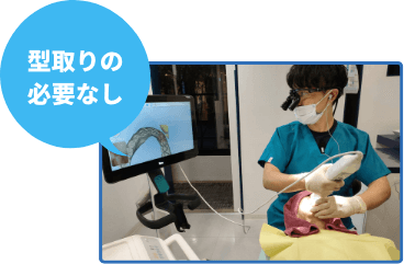 型取りの必要なし